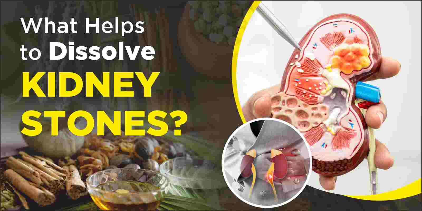 Ayurvedic treatment for kidney stones